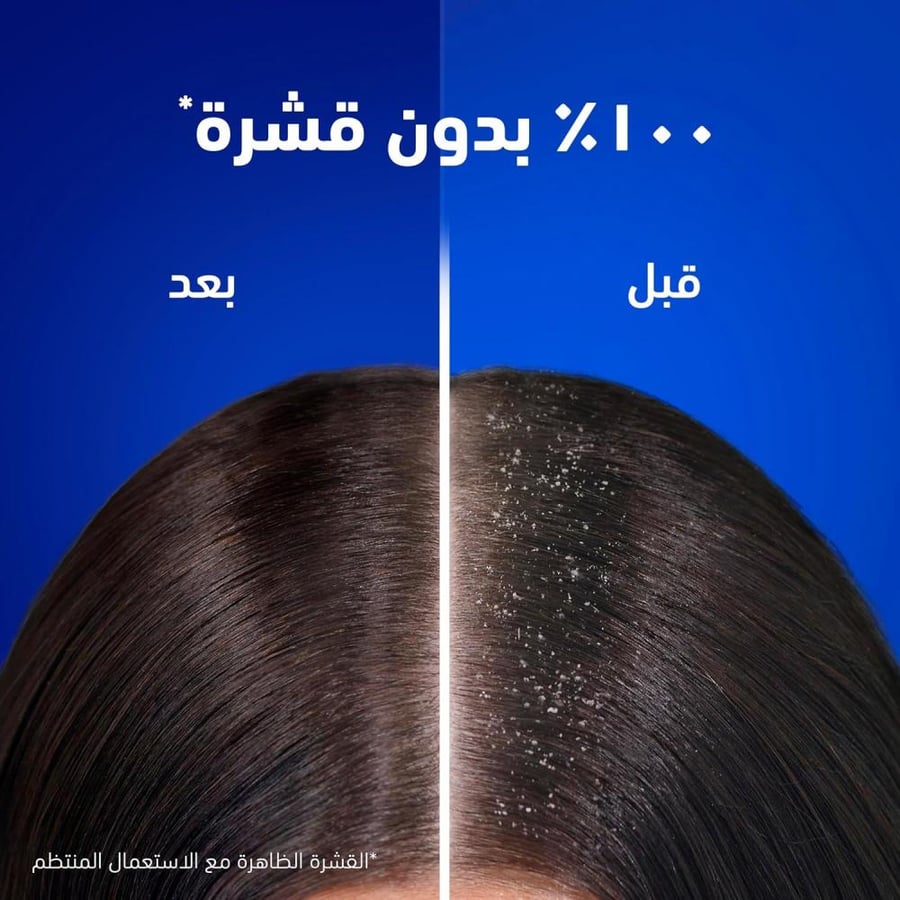 هيد اند شولدرز بلسم 360 مل عناية لفروة الرأس