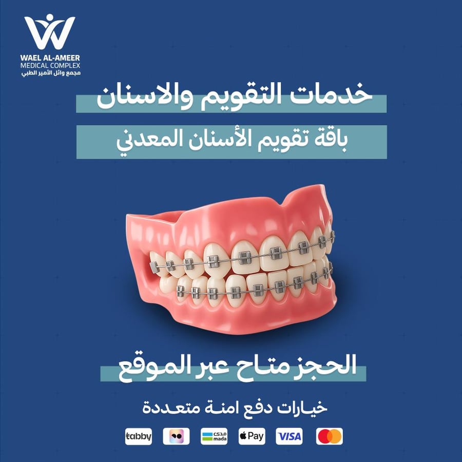 باقة تقويم الأسنان المعدني