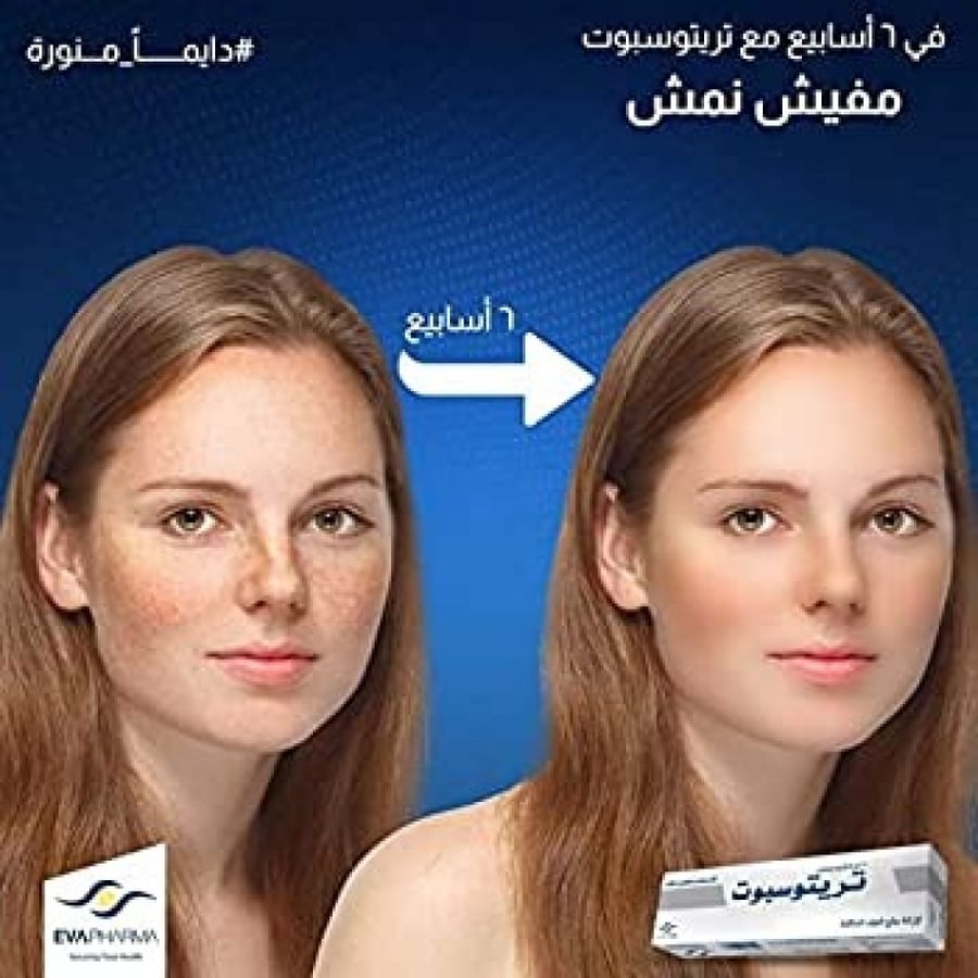 كريم تريتوسبوت لازاله البقع الداكنة 15 جرام.