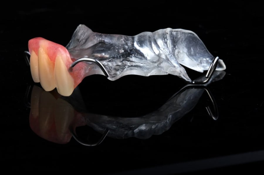 250. طقم جزئي علوي سن واحد فقط بحد 5 اسنان Upper Partail denture one tooth to 5