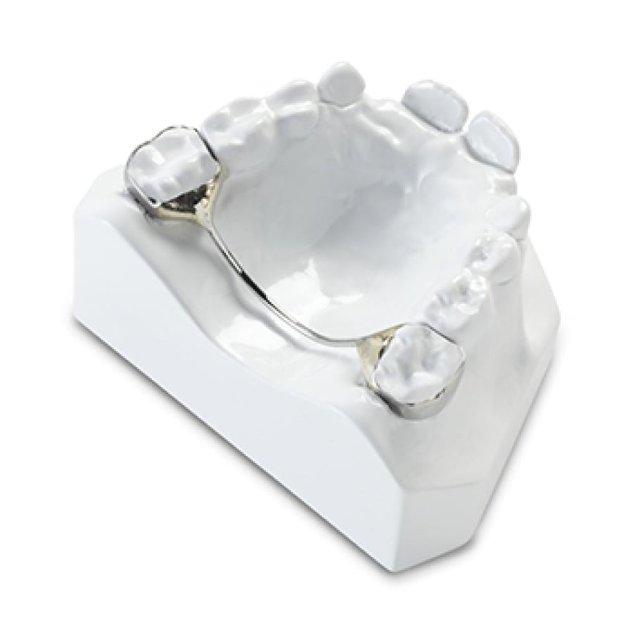 228. Transpalatal orthodontic device without loop TPA transpalatal without loop