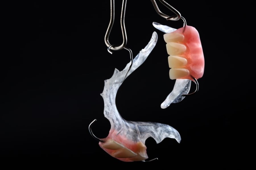 251. طقم جزئي سفلي سن واحد بحد اقصي 5 اسنان  Lower partial denture one tooth to 5