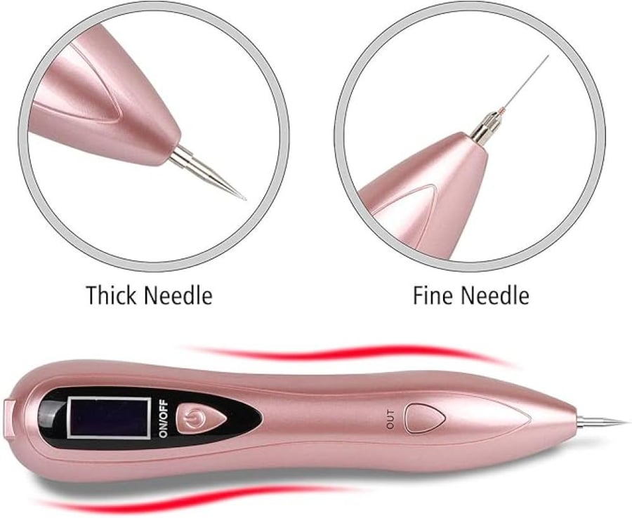 Laser pen machine for removing dark spots
