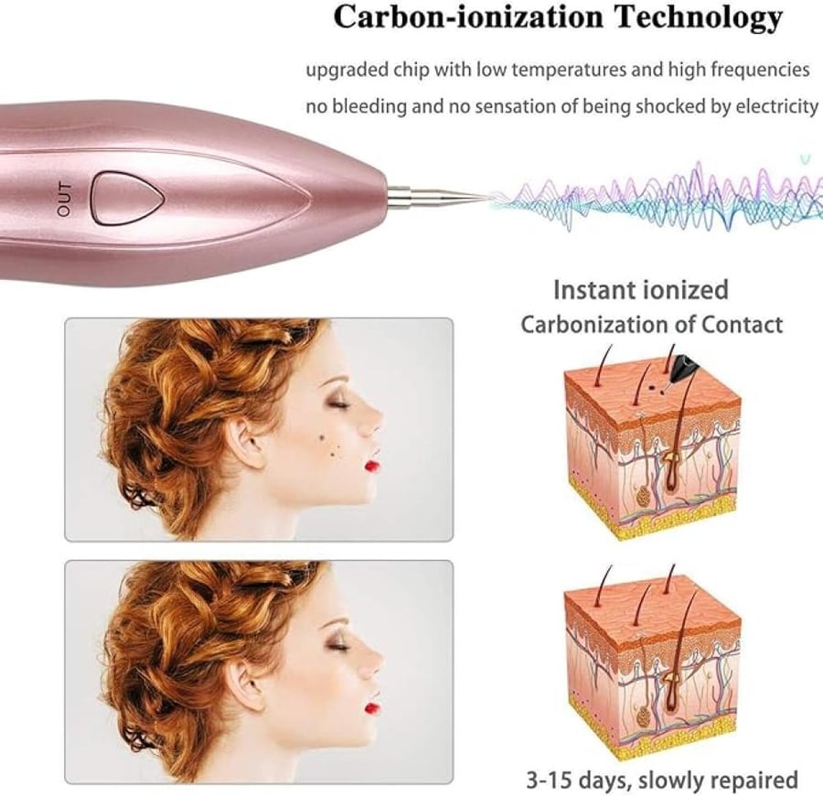 Laser pen machine for removing dark spots