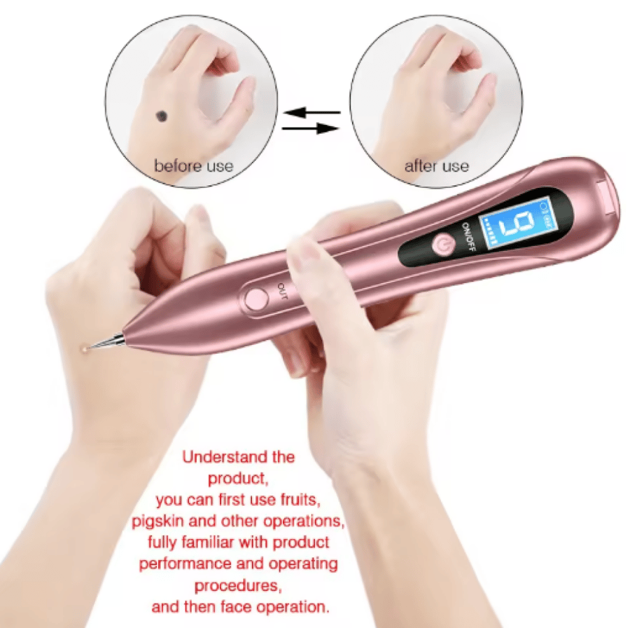 Laser pen machine for removing dark spots