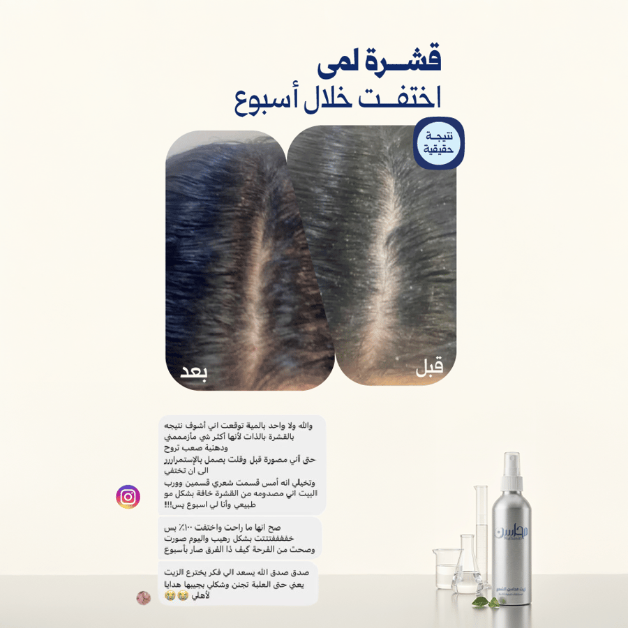 عبوتين زيت محاسن الشعر بـ269