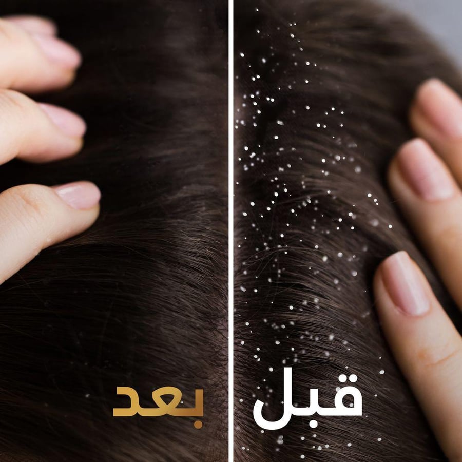 بانتين شامبو شعر 375 مل برو-في ضد القشره 2في1.  Pantene Pro V Anti-Dandruff 2-in-1 Shampoo 375 ml
