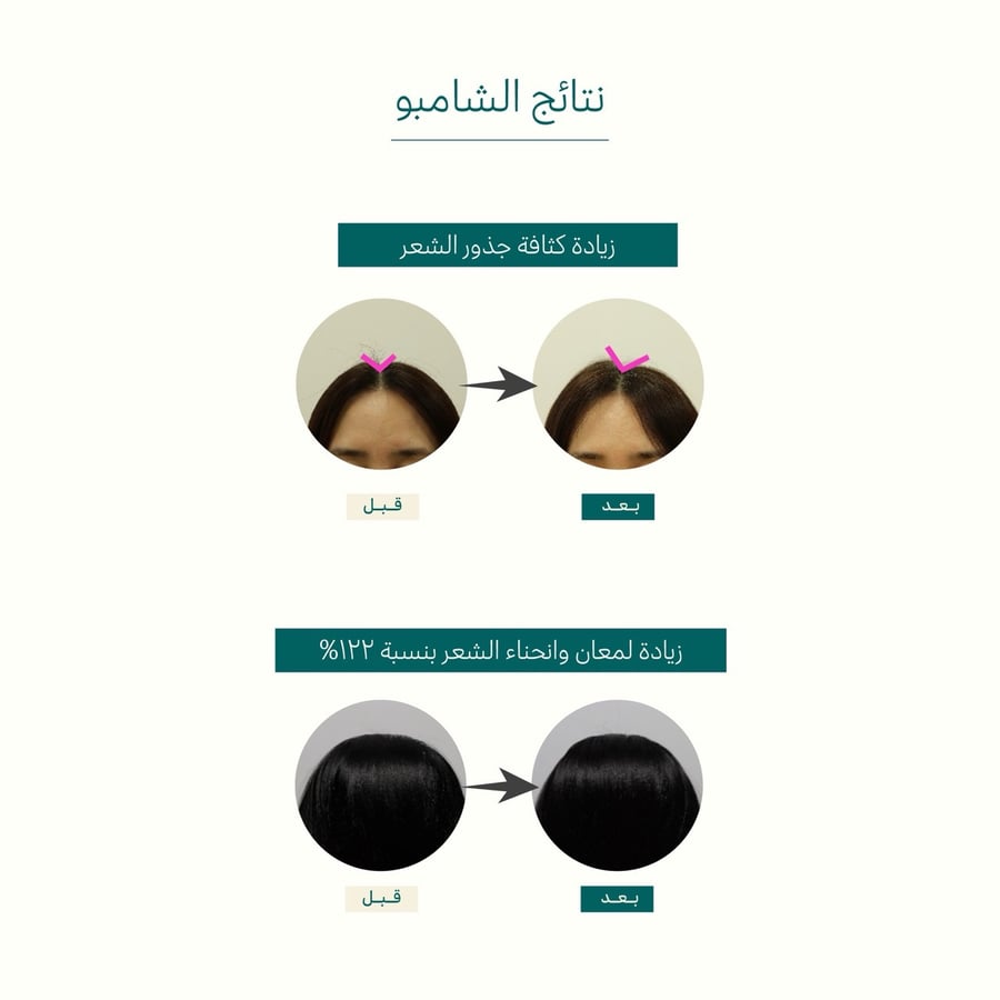 شامبو الكولاجين الصباحي لكثافة وتنعيم الشعر 360 مل من تريسيل