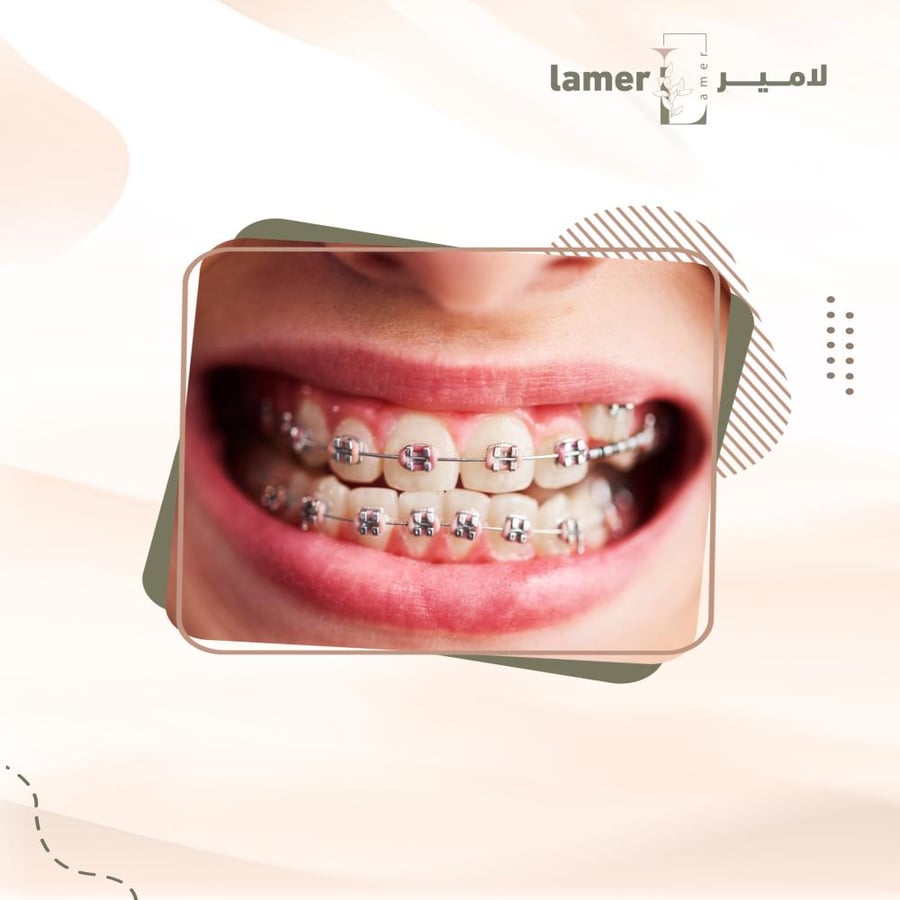 الدفعة الاولي للتقويم العلاجي ( شامل الاشعة والخطة العلاجية )