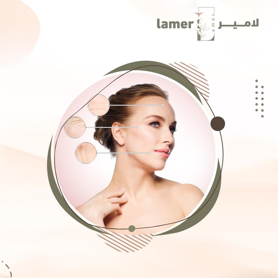 بوتكس التعرق