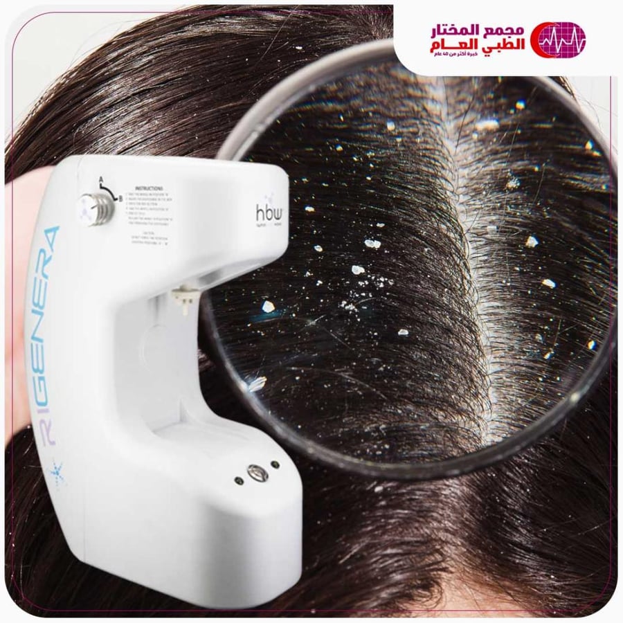 بكج الريجينيرا ( بديل زراعة الشعر )