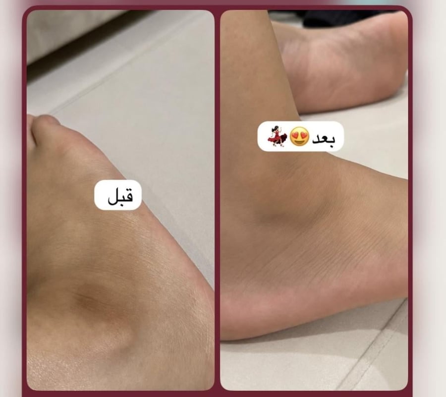 بكج التفتيح .صابونيه اعشاب  +مقشر  القهوه المعالج
