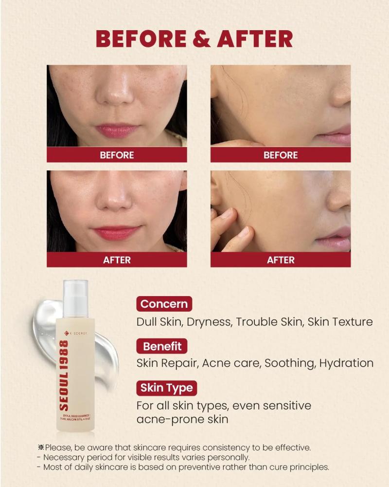 سيروم سيول