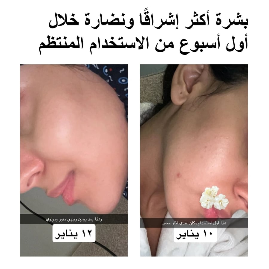 تونر سيدني  100ml لتقشير البشرة وتنعيمها بأحماض AHA