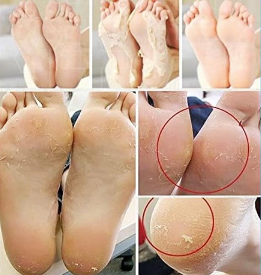 جوارب تقشير القدمين الكورية إم بيوتي باللافندر 40 جم - MBeauty