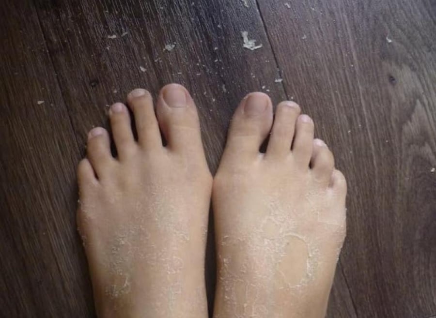 جوارب تقشير القدمين الكورية إم بيوتي باللافندر 40 جم - MBeauty