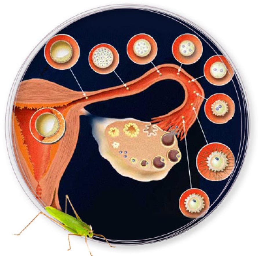 Ovulation monitoring ultrasound package