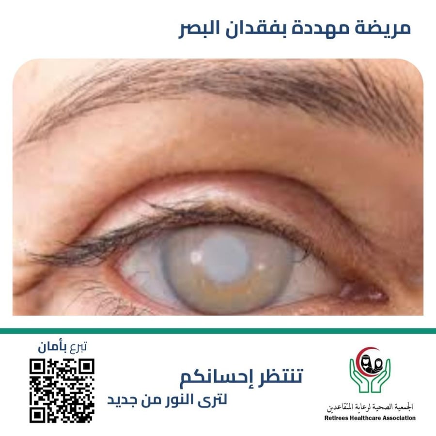 عملية جراحية لعين أم لأطفال