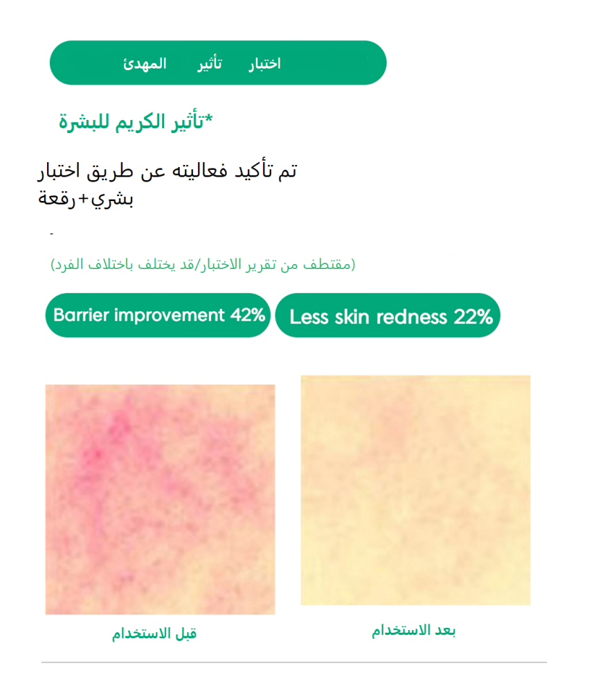 كريم اصلاح البشرة بالكيكا 100 مل