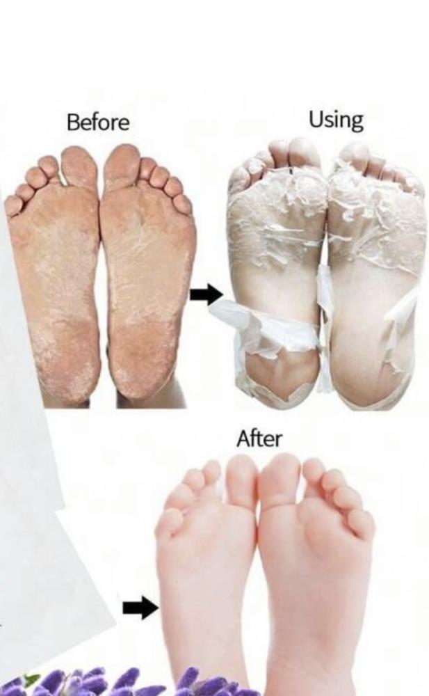Foot scrubber