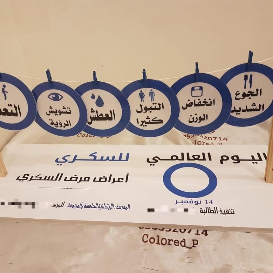 مجسم حبل الغسيل