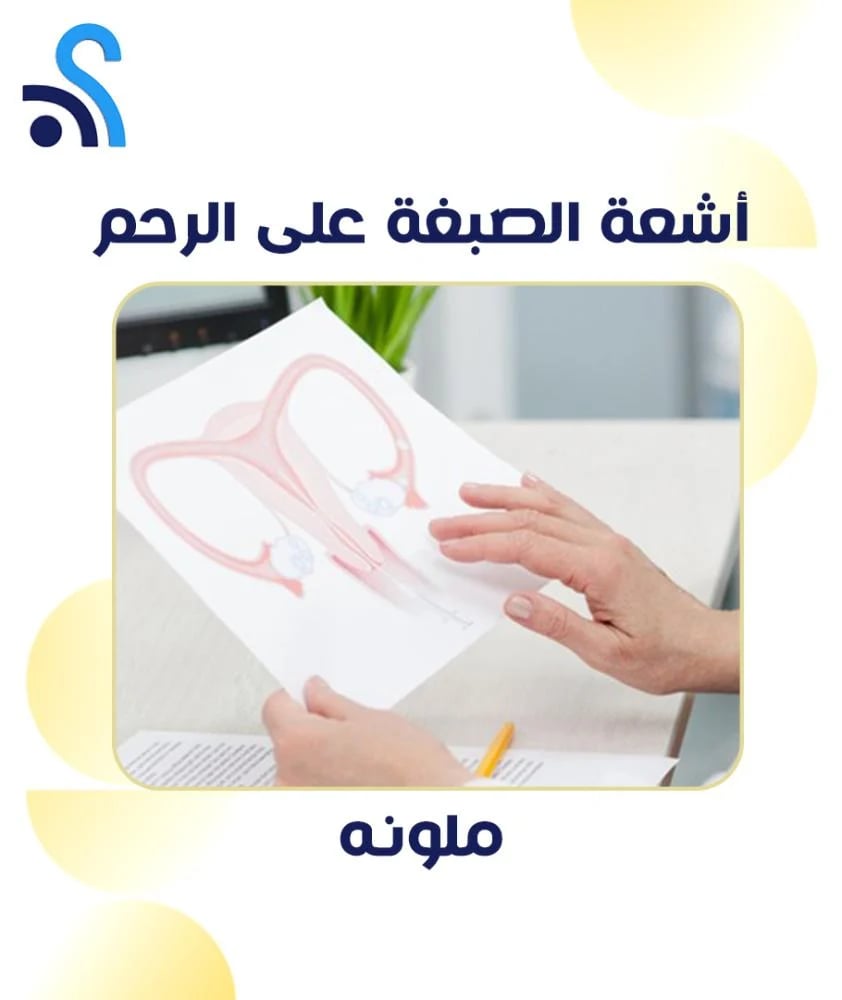اشعة الصبغة على الرحم