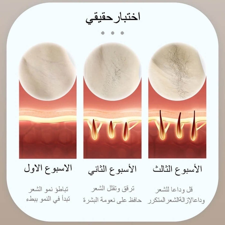 ليزر ملاي T14 عدسة وحدة