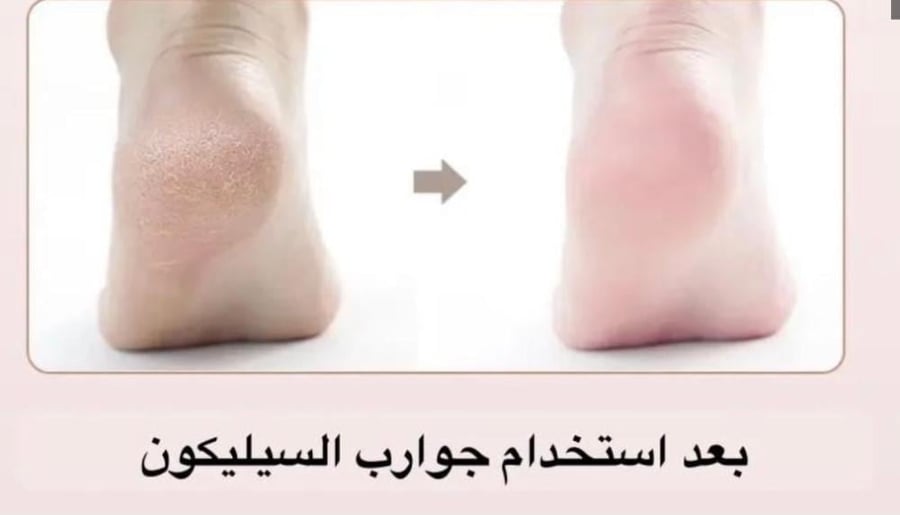 جوارب من السيلكون غير قابل للإنزلاق