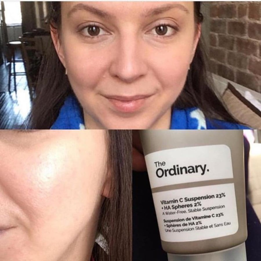 فيتامين سي 23٪ من حمض الأسكوربيك النقي، ذا اورديناري