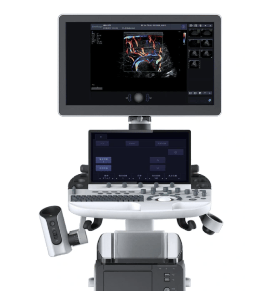جهاز سونار SonoScape P40 بتقنية 4D والدوبلر الملون مع أربع مجسات