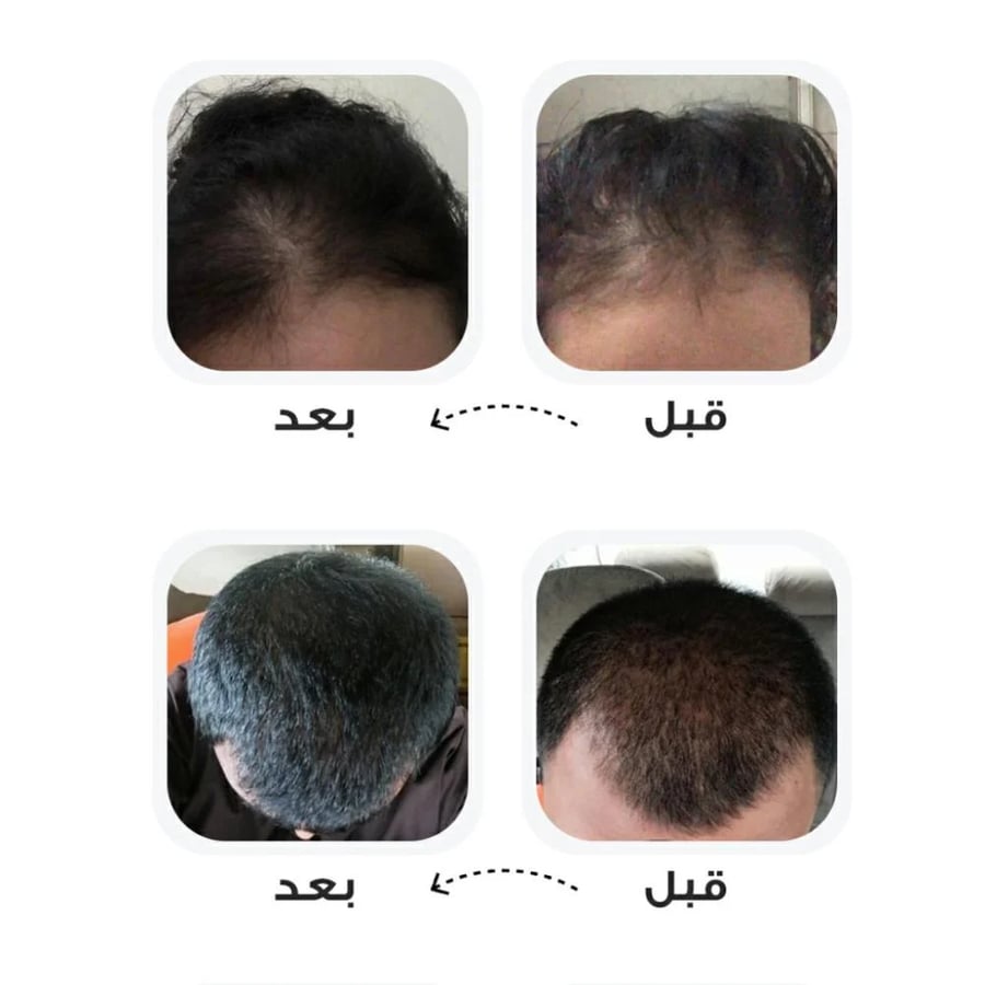 عبوة + عبوة مجاناً زيت السلطان
