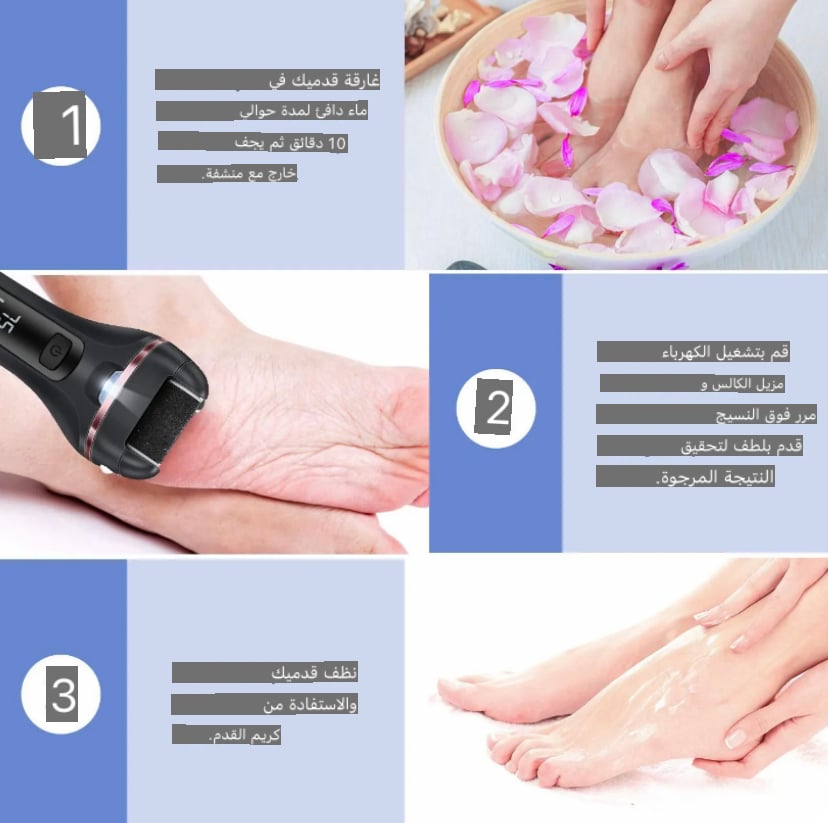 طقم العناية بالقدم ازالة الجلد الميت USB