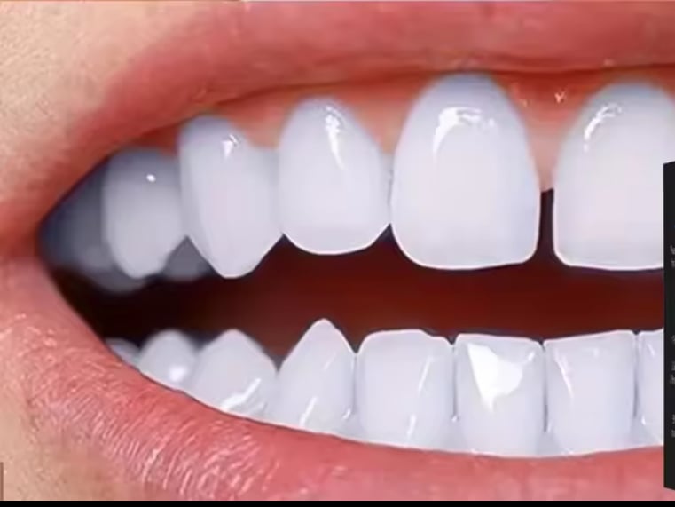 7 أزواج من شرائط تبييض الأسنان  + 7 أزواج من شرائط تبييض الأسنان هدية المتجر