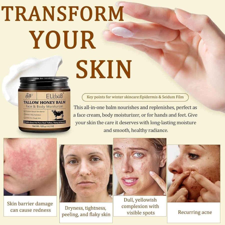 كريم مرطب للجسم والوجه بالعسل الطبيعي وشمع النحل – Tallow Balm – مناسب للبشرة الحساسة