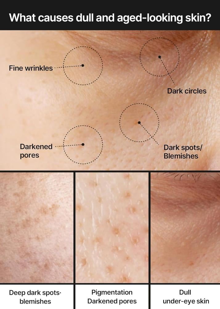 كريم تفتيح بور + دارك سبوت من سيليماكس لعلاج المسام الواسعة وتوحيد لون البشرة وإزالة البقع الداكنة - 35 مل