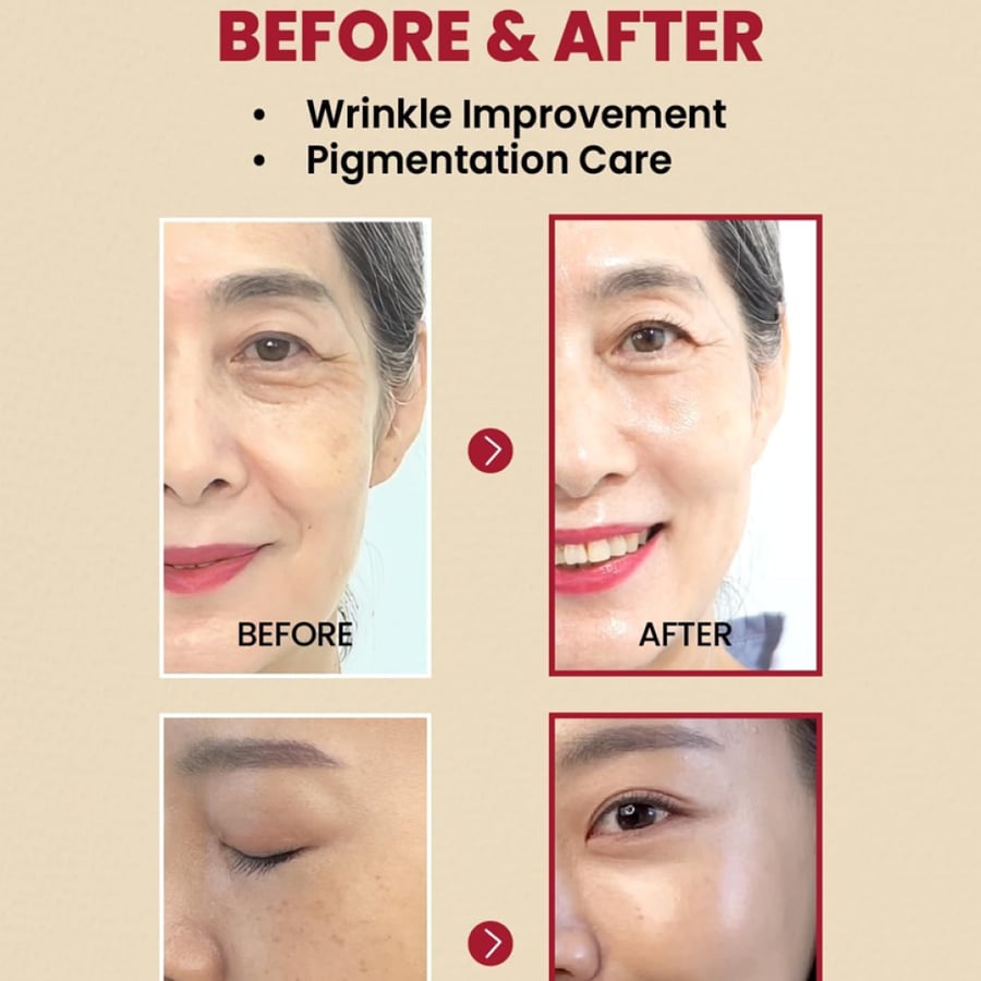 Seoul 1988 Retinal & Black Ginseng Serum by Keysecret – 30ml