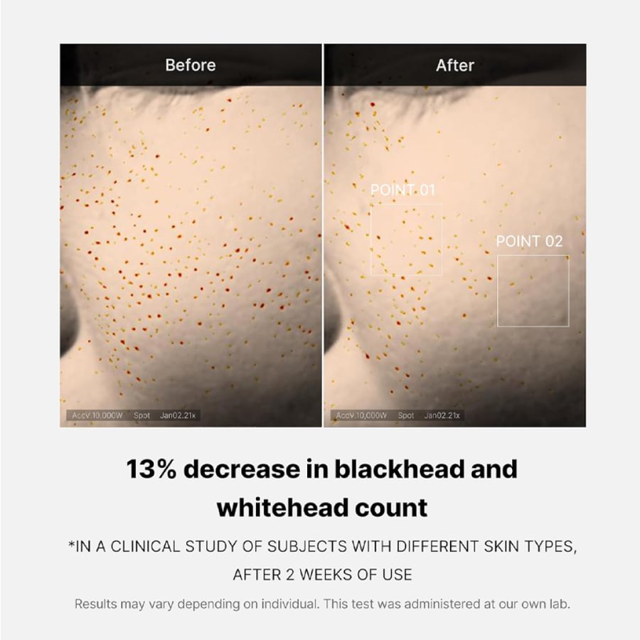 Serum Medicube Zero Pore One-Day – 30ml