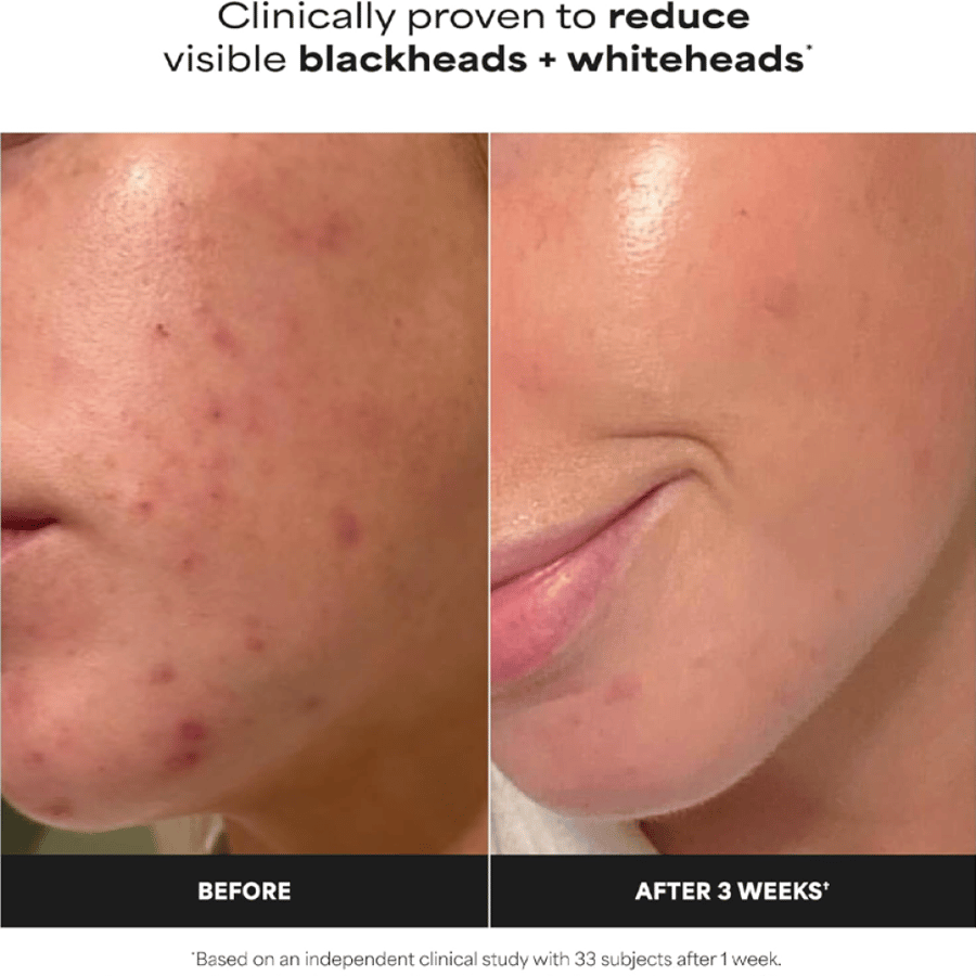 Paula’s Choice 2% BHA Skin Perfecting Exfoliant - 118 ml