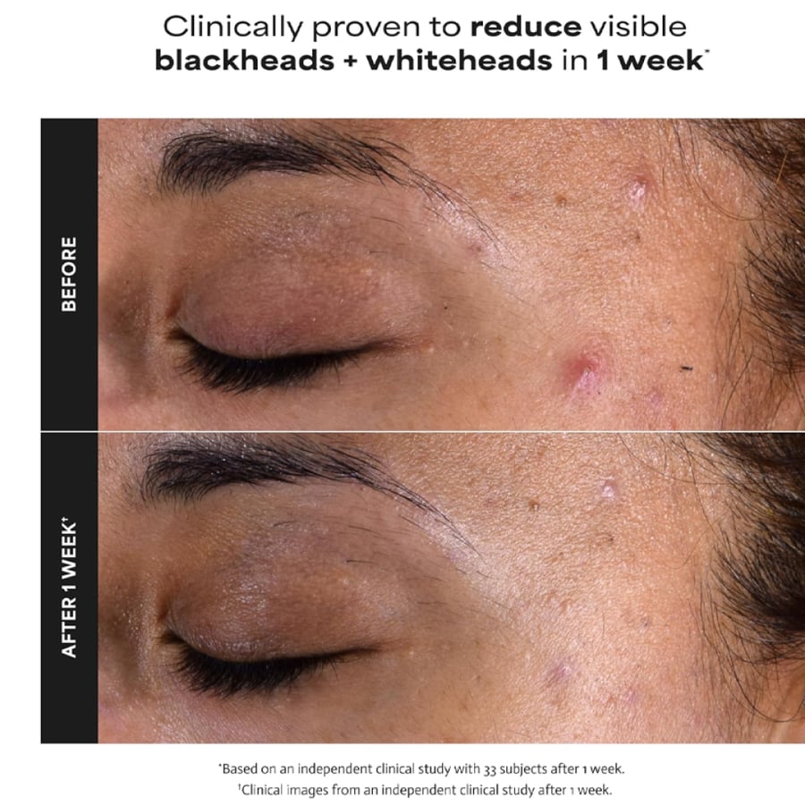 Paula’s Choice 2% BHA Skin Perfecting Exfoliant - 118 ml
