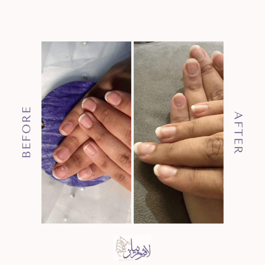 زيت أظافر