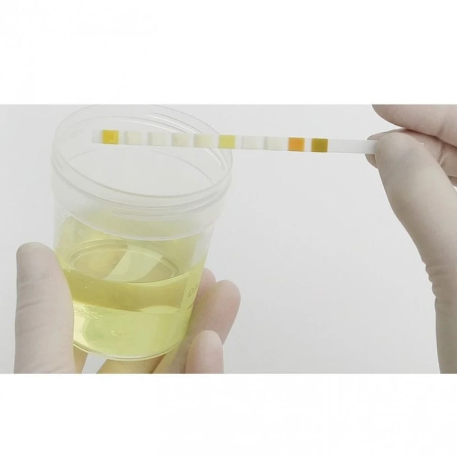 Urine test strips Comberton