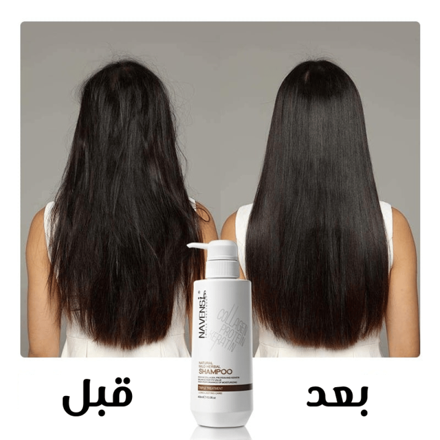 شامبو طبيعي للشعر الجاف هيربال ناتشورال