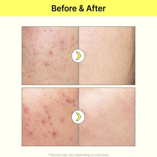 Tiam Serum 40 ml Intensive Brightening and Even Skin Tone with Vitamin B3