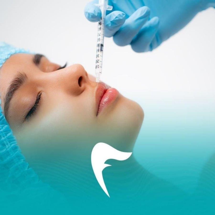 1مل فيلر توسيال