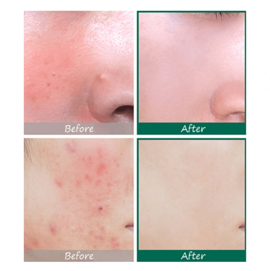 SOME BY ME 30 Days Miracle Serum, 50 ml