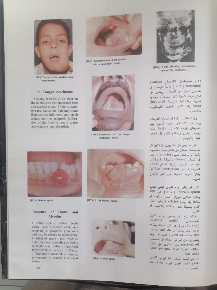 Lessons in clinical surgery Dr. Mohamed Abdel Latif Ibrahim President of Zagazig University used