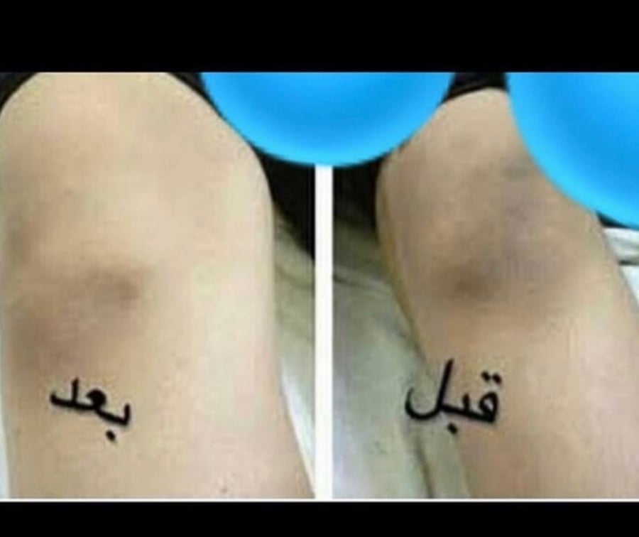 مقشر بيلسان 75مل