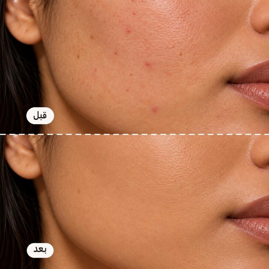 قبل وبعد كريم أساس Make Up For Ever HD Skin على البشرة
