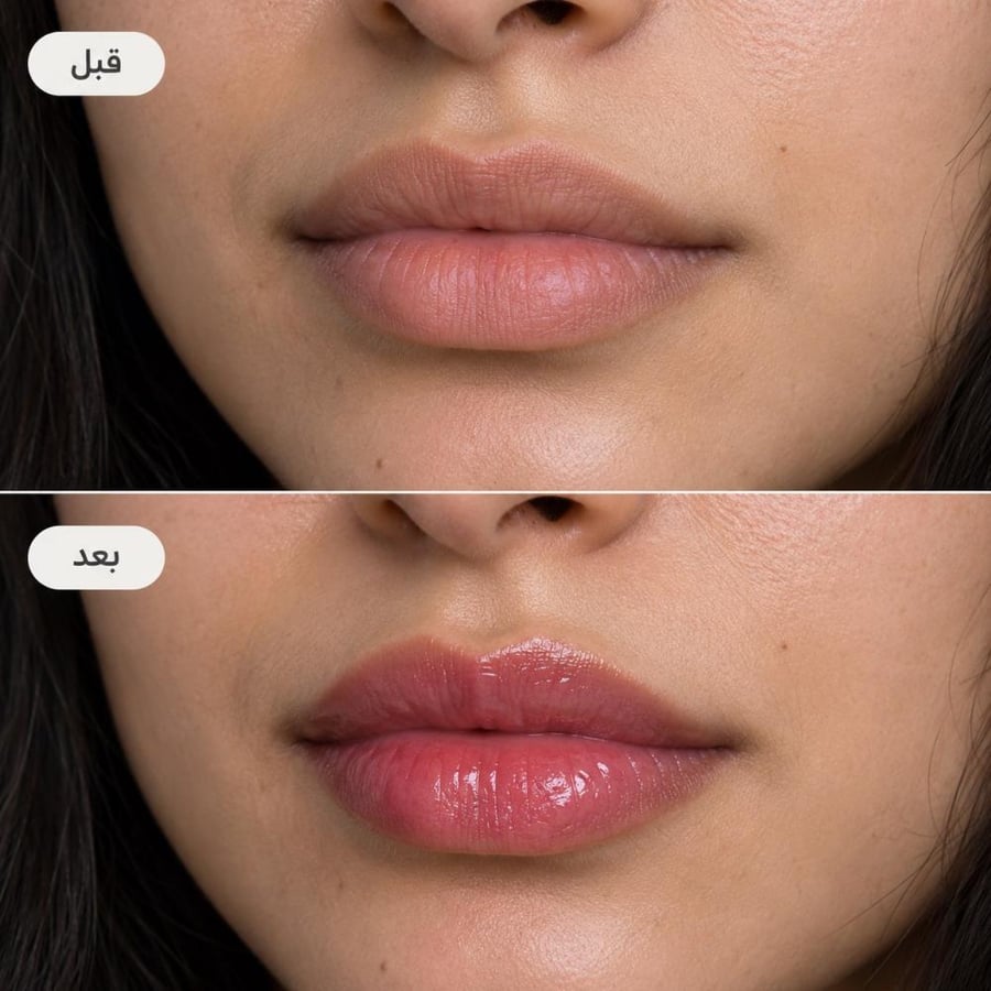 قبل وبعد زيت شفاه Bogenia Lip Oil