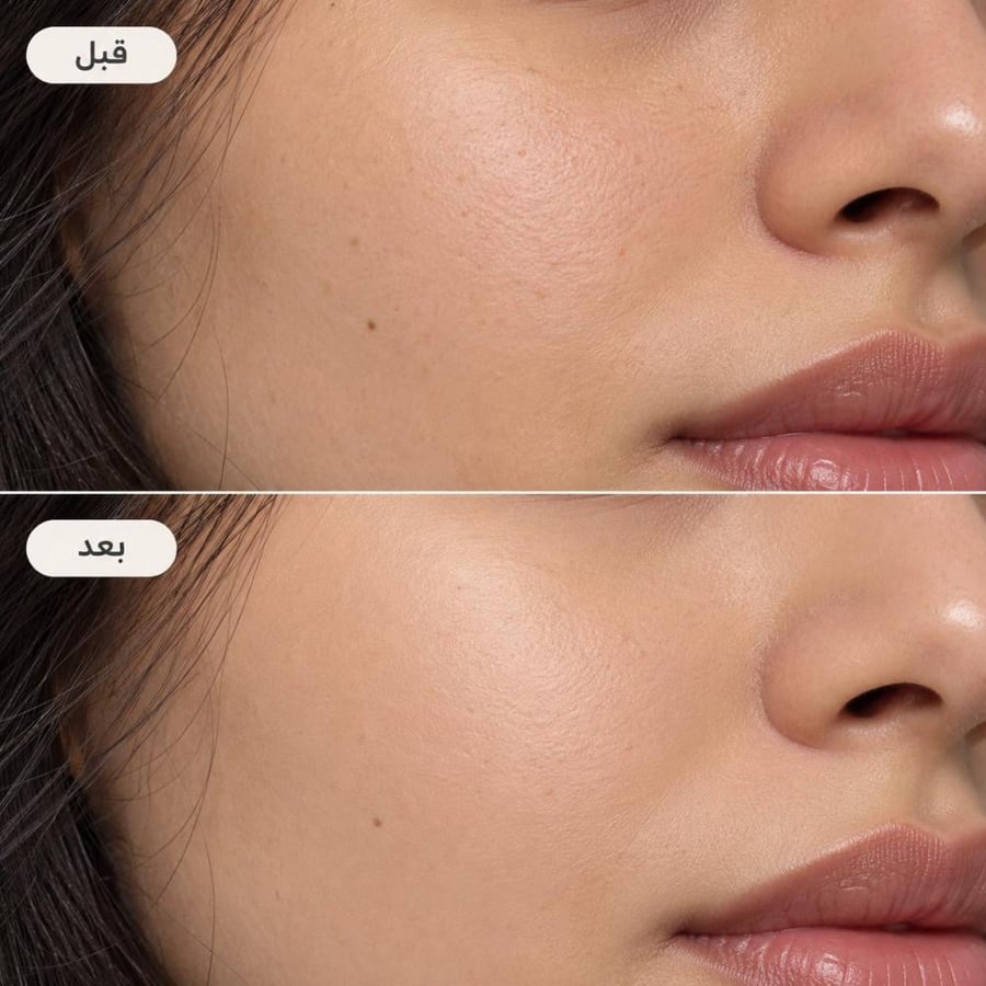 قبل وبعد بودرة وجه مضغوطة CALORENA Secret